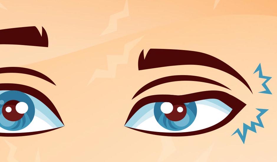Eye Twitching: Types, Causes, Symptoms, and Treatments 